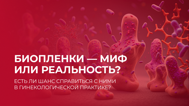 Биоплёнки — миф  или реальность?